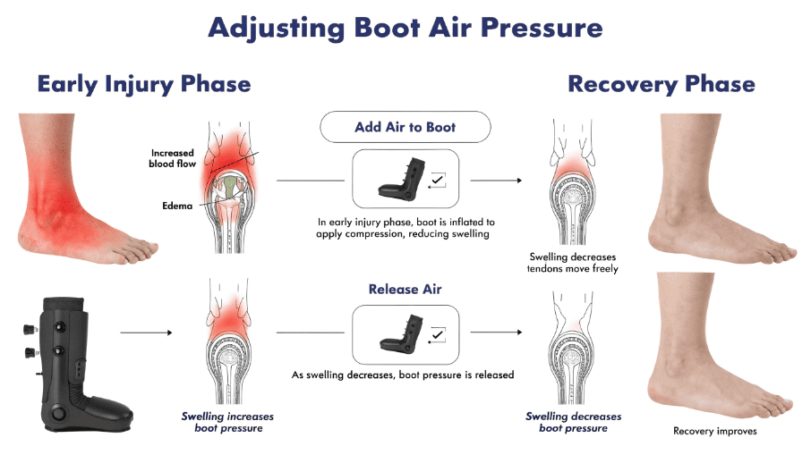 adjusting air pressure in pneumatic walking boot